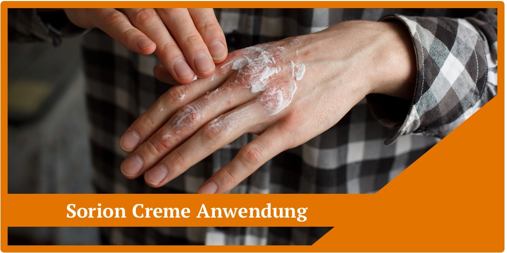 Sorion Creme Anwendung