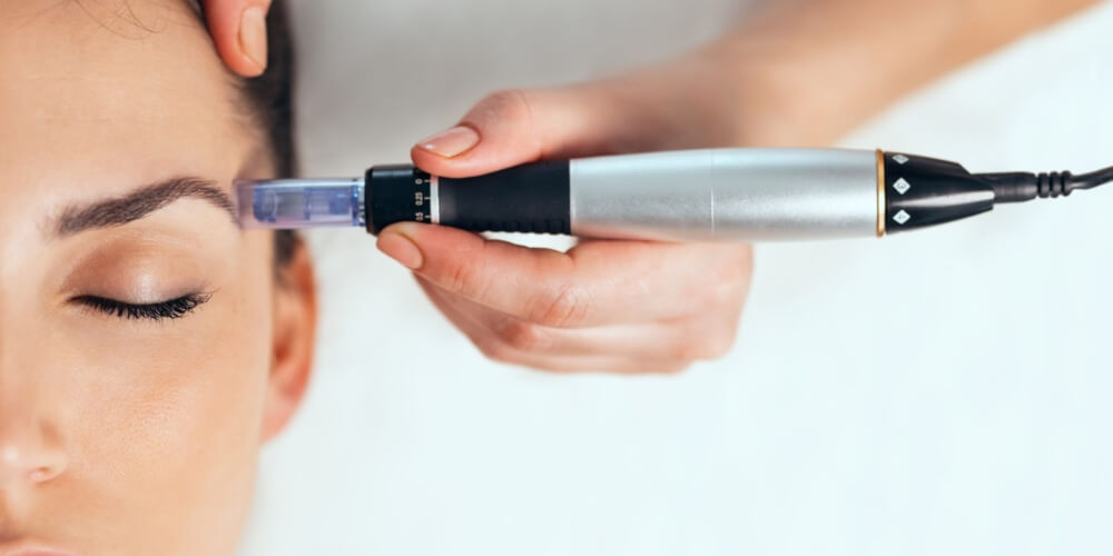 Microneedling für zuhause Dermaroller